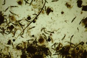 demodex